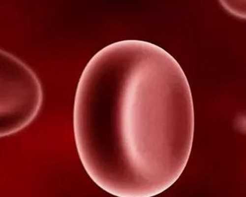 摆脱多囊卵巢综合征困扰：专家教您如何治疗