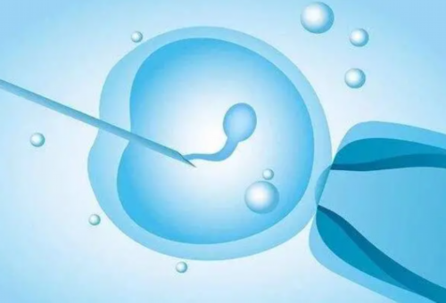 子宫内膜异位症：揭示其神秘面纱，了解女性健康的隐形杀手！