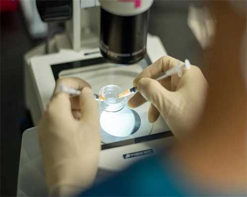 <b>月经规律是否能自证多囊卵巢？揭秘六大诊断大招！</b>