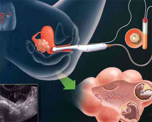 深圳做第二代试管可以用医保支付吗？附深圳第三代试管婴儿政策？