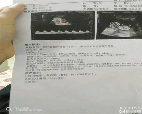 黑龙江借卵子试管婴儿成功案例,卵巢癌复发能好